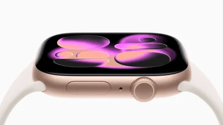 Series 11 4 Series 11 4